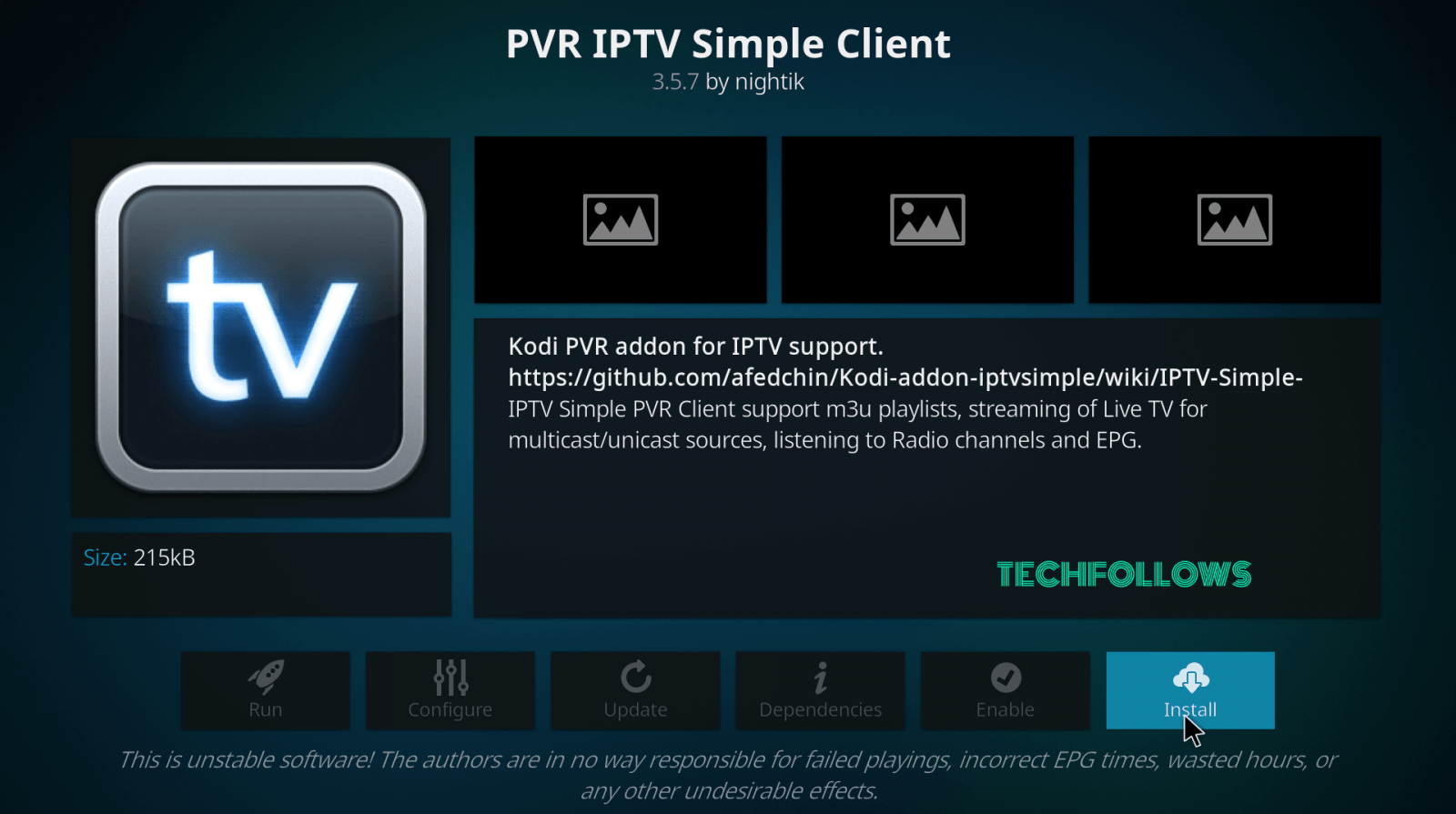 IPTV-on-Xbox-6